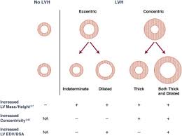 Image result for  ^ L V [ h    