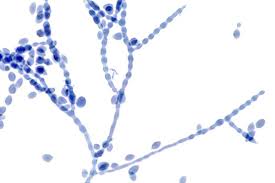Attēlu rezultāti vaicājumam “Lophozia laxa macro”