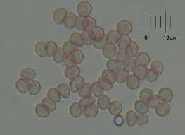 Attēlu rezultāti vaicājumam “Comatricha alta stalked”