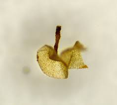 Attēlu rezultāti vaicājumam “Heterotrichia obvelata (syn. Arcyria obvelata) young”