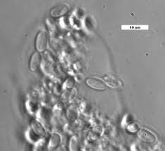 Attēlu rezultāti vaicājumam “Dianema nivale spores”