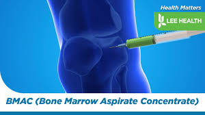 Image result for BMAC