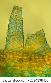 Attēlu rezultāti vaicājumam “Orthotrichum anomalum sporophyte”