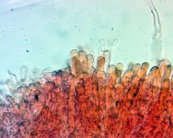 Attēlu rezultāti vaicājumam “Rimbachia neckerae”