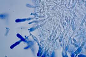 Attēlu rezultāti vaicājumam “Cylindrobasidium evolvens”