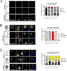 Attēlu rezultāti vaicājumam “Dianema depressum plasmodium”