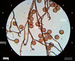 Attēlu rezultāti vaicājumam “Enerthenema papillatum spores”