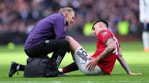 Image result for Manunitid