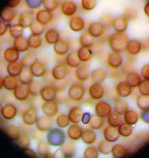 Attēlu rezultāti vaicājumam “Stemonitopsis hyperopta var. landewaldii stalked”