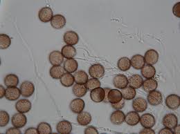 Attēlu rezultāti vaicājumam “Diderma effusum spores”