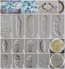 Attēlu rezultāti vaicājumam “Didymium spongiosum var. dictyospora”