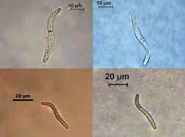 Attēlu rezultāti vaicājumam “Lasiosphaeria ovina”