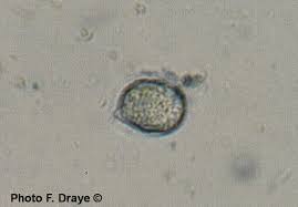 Attēlu rezultāti vaicājumam “Radulomyces confluens”