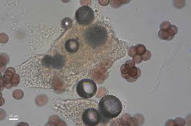 Attēlu rezultāti vaicājumam “Amaurochaete fusiformis macro”