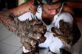 Image result for Lewandowsky-Lutz