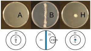 Attēlu rezultāti vaicājumam “Heterotrichia oerstedii (syn. Arcyria oerstedii) spores”