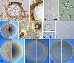 Attēlu rezultāti vaicājumam “Stemonitopsis aequalis var. microspora stalked”