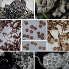 Attēlu rezultāti vaicājumam “Amaurochaete atra spores”