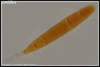 Attēlu rezultāti vaicājumam “Bactridium flavum”