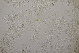 Attēlu rezultāti vaicājumam “Erythricium aurantiacum”