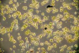 Attēlu rezultāti vaicājumam “Pleurococcus vulgaris”