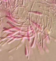 Attēlu rezultāti vaicājumam “Phlebia rufa”