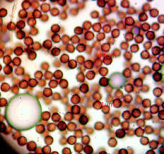 Attēlu rezultāti vaicājumam “Diderma subviridifuscum”