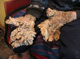 Image result for Lewandowsky-Lutz