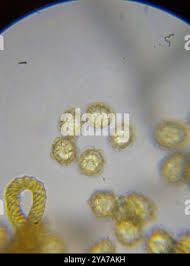 Attēlu rezultāti vaicājumam “Oligonema favogineum”