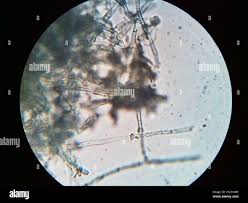 Attēlu rezultāti vaicājumam “Byssocorticium atrovirens”