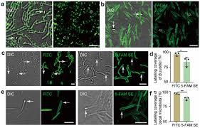 Attēlu rezultāti vaicājumam “Diderma subviridifuscum spores”
