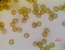 Attēlu rezultāti vaicājumam “Trichia scabra spores”