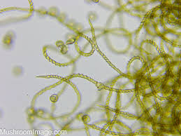 Attēlu rezultāti vaicājumam “Trichia contorta spores”