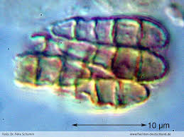 Attēlu rezultāti vaicājumam “Arthonia leucopellaea”