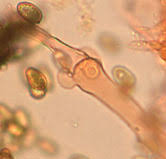 Attēlu rezultāti vaicājumam “Coniophora puteana”