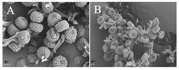 Attēlu rezultāti vaicājumam “Chaenotheca stemonea”
