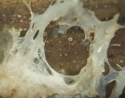 Attēlu rezultāti vaicājumam “Didymium serpula young”