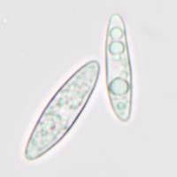 Attēlu rezultāti vaicājumam “Ascocoryne cylichnium”