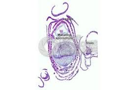 Attēlu rezultāti vaicājumam “Sphagnum centrale sporophyte”