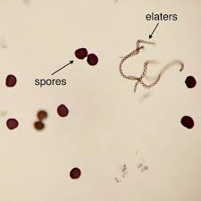 Attēlu rezultāti vaicājumam “Fossombronia wondraczekii spores”