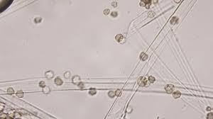 Attēlu rezultāti vaicājumam “Tranzschelia pruni-spinosae spores”