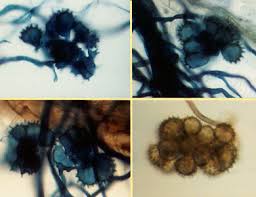 Attēlu rezultāti vaicājumam “Enteridium olivaceum spores”