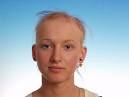 Herbal Plants Considered Best Baldness Treatments Today