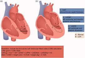 Image result for  ^ L V [ h    