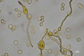 Attēlu rezultāti vaicājumam “Hemitrichia sordivesiculosa macro”