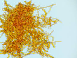 Attēlu rezultāti vaicājumam “Badhamiopsis praetermissa macro”