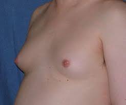 http://t0.gstatic.com/images?q=tbn:ANd9GcStca27Lhd3KLLVpUjcARr2b2oBZGtg10KyrHhdlX40ntGULMQuPw