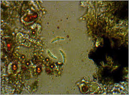 Attēlu rezultāti vaicājumam “Opegrapha rufescens”