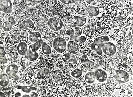 Attēlu rezultāti vaicājumam “Physarum flavidum sessile”
