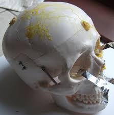 Attēlu rezultāti vaicājumam “Physarum penetrale stalked”